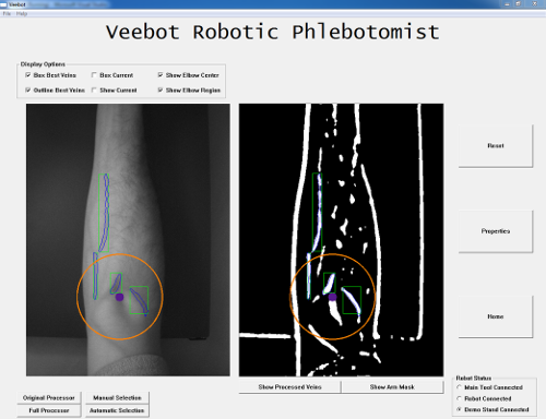 Analyse des veines d'un bras grâce au logiciel utilisé par le robot